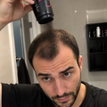 NOVRA™ Precision Kit